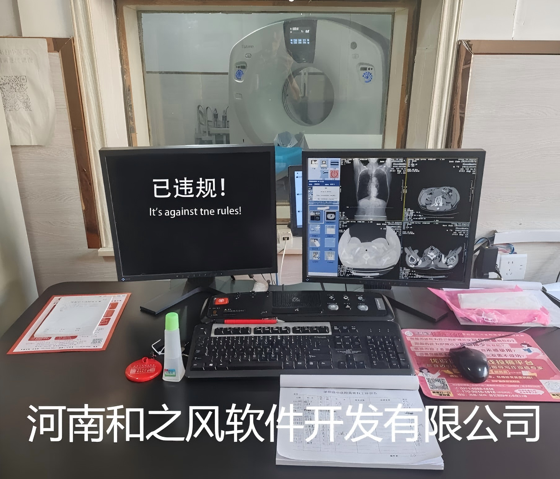 CT���˴ſ��҆��÷�©�M(f��i)ϵ�y(t��ng)�����x